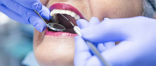 Best Knocked-Out Tooth (Avulsed Tooth) Treatment in Rose Valley, PA